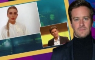 Armie Hammer'ın fantezilerini Dr. Mehmet Öz'e anlattı