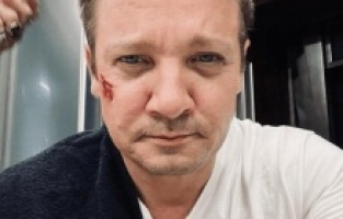 Ünlü oyuncu Jeremy Renner kaza geçirdi!